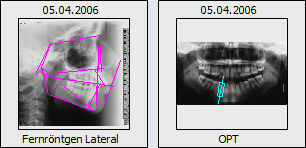 imagetypes_2d_xray.png